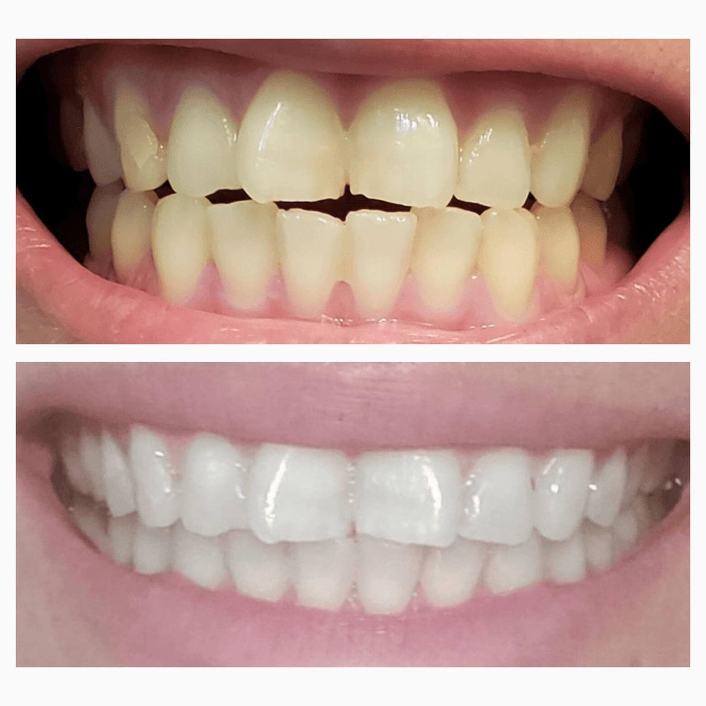 Magic Whitening Toothpaste Booster® Powder with Hydroxyapatite