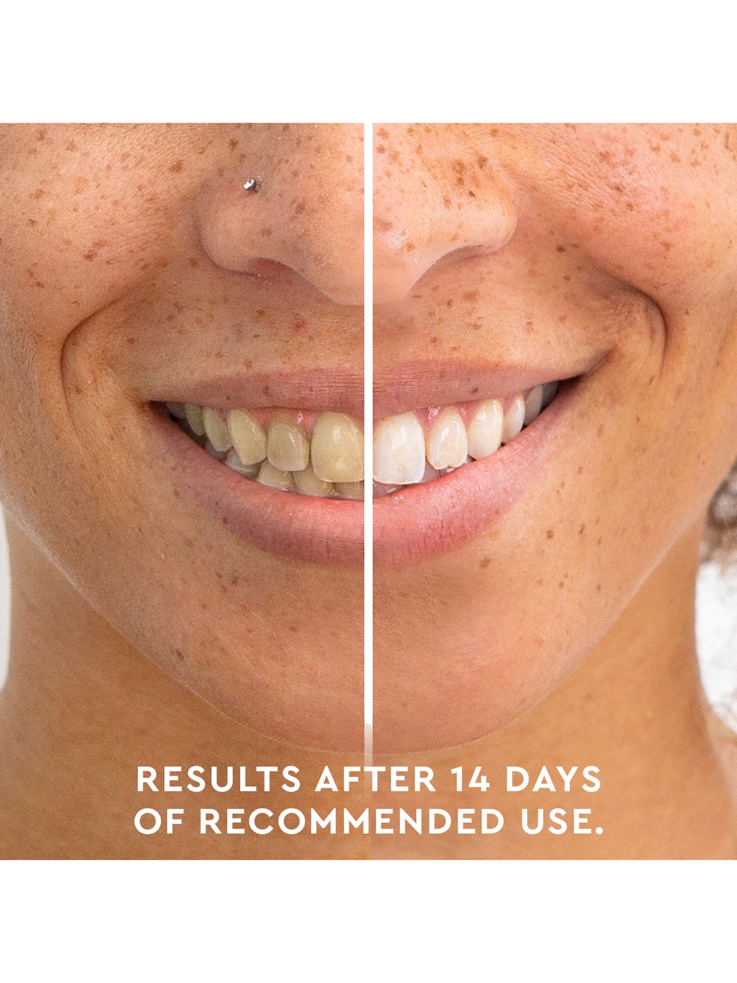 Teeth Whitening Pen Holiday Duo
