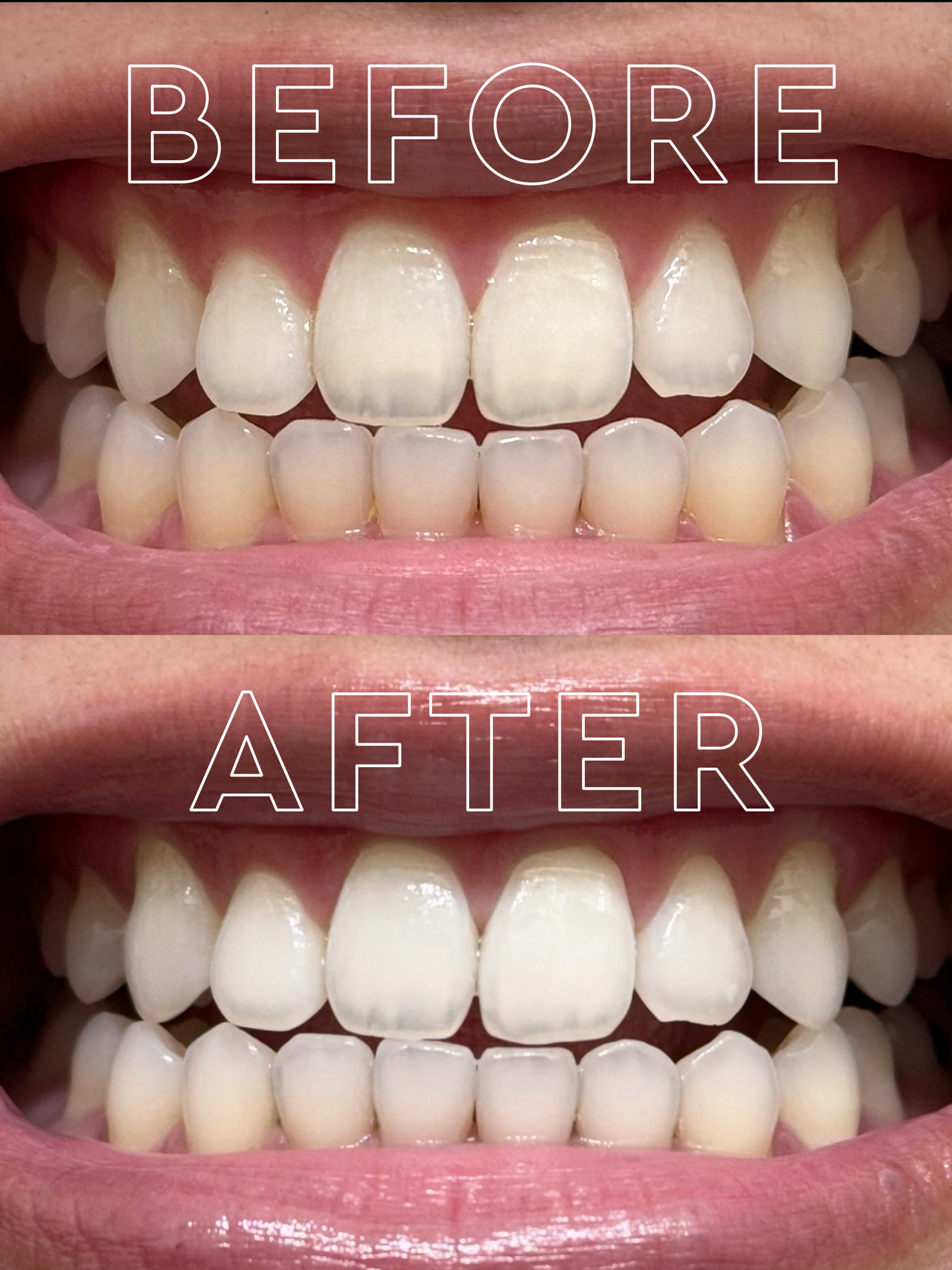Purple Color Corrector Toothpaste